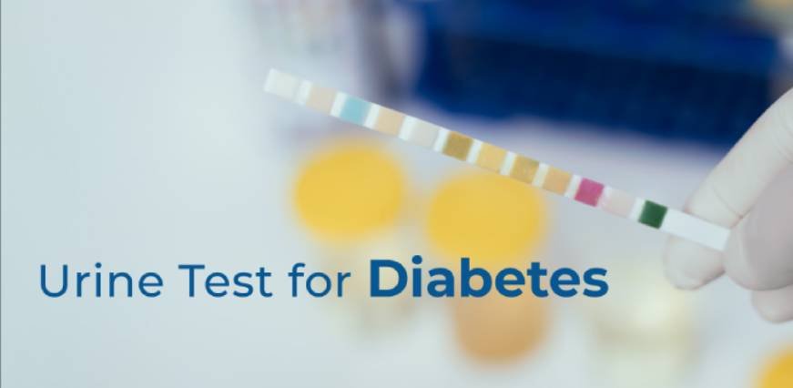 Glucose 24 Hrs Urine Test