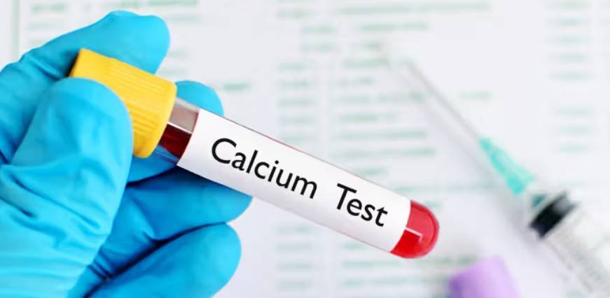 Calcium Test