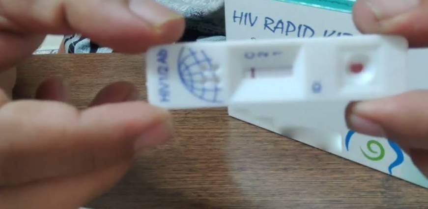 HIV Rapid Test