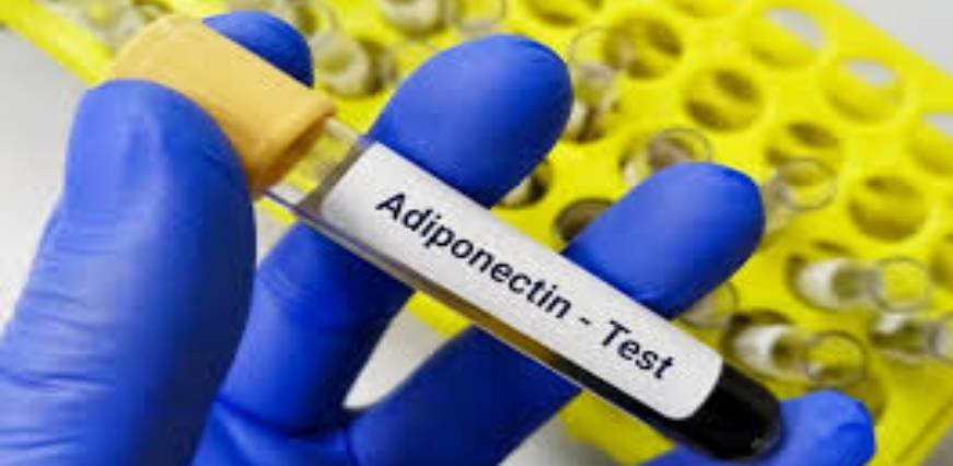Adiponectin Test