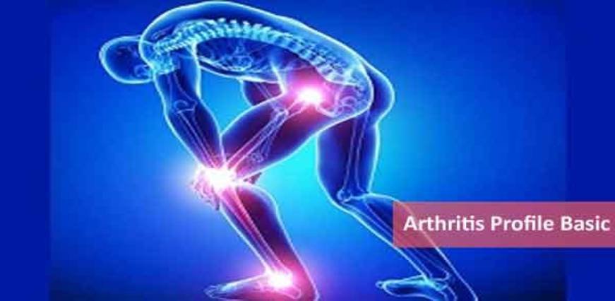 Arthritis Profile