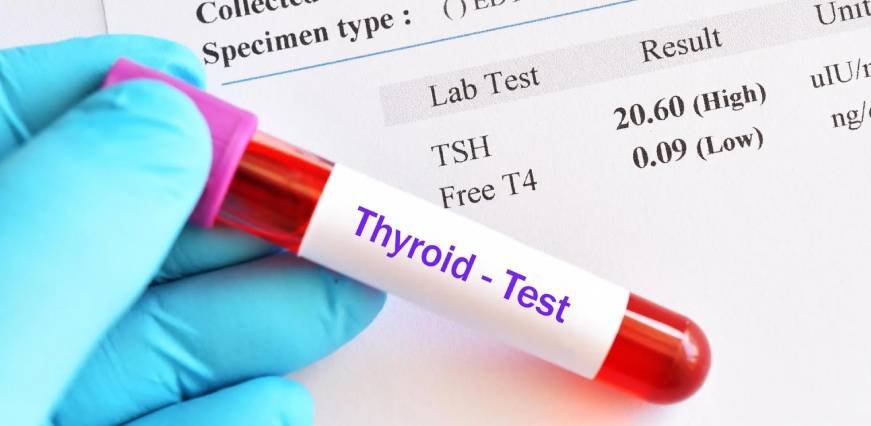 Thyroid Panel II (Serum Test)